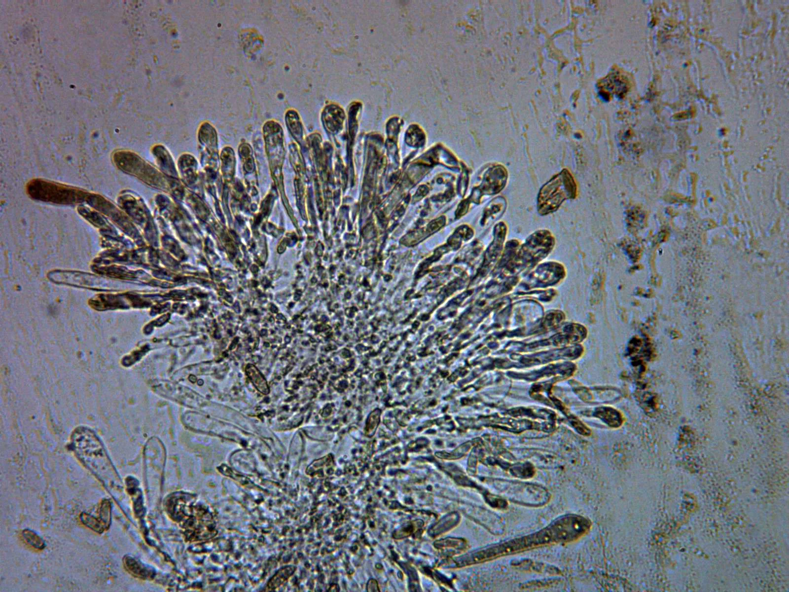 Microscopía de Suillus mediterraneensis - 10 - Caulocistidios x 400
